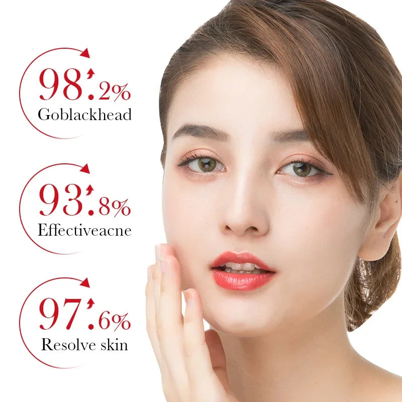 BIOAQUA Salicylic Acid Acne Removing